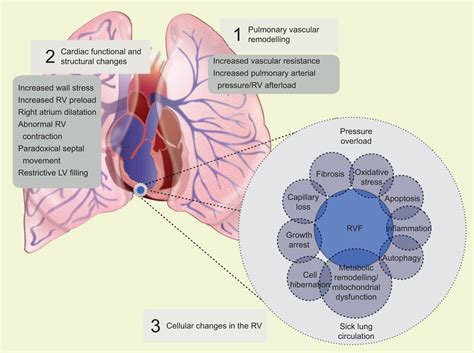 lung expansion lv rv lressure